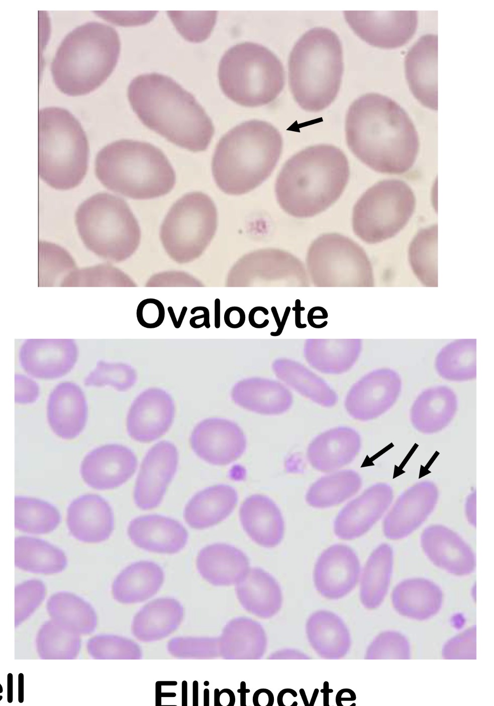 <p>Elliptocytes are longer</p><p></p>