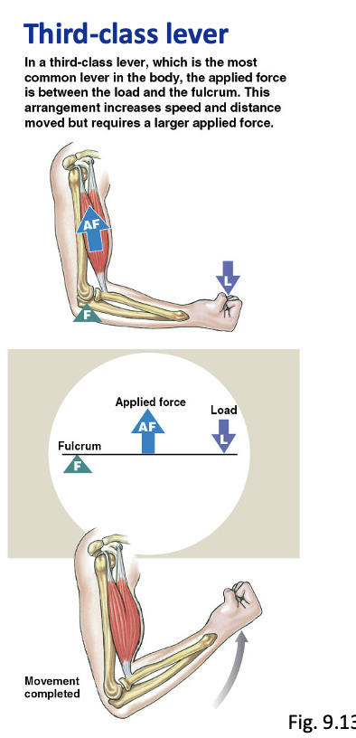 <p>applied force in the middle (most common)</p>