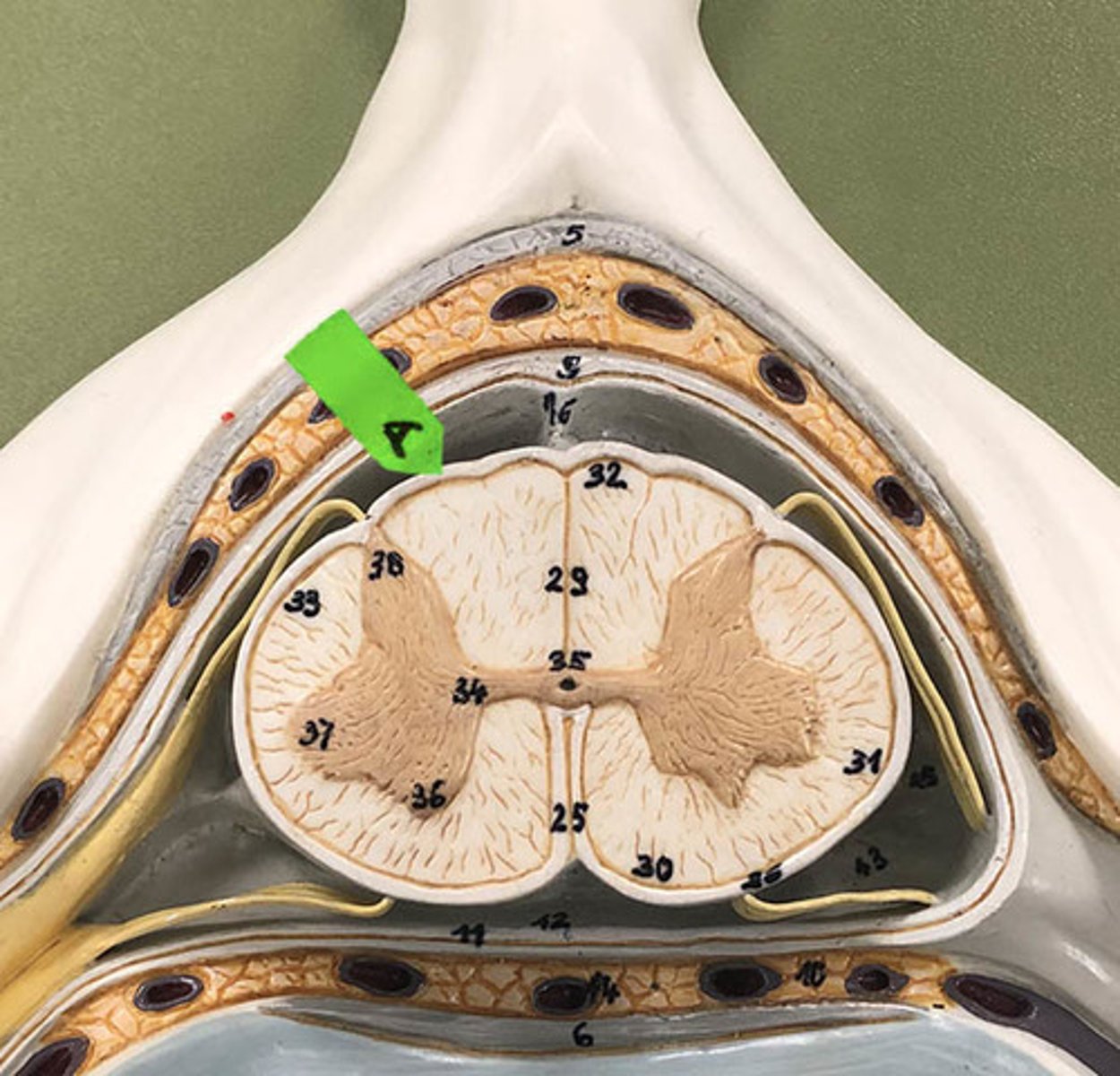 <p>Identify this layer of meninges.</p>