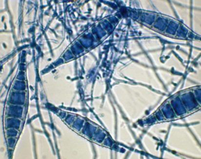 <p>Causes skin and scal infections</p><p>Zoonotic</p><p>Thick shelled macrocondida</p>