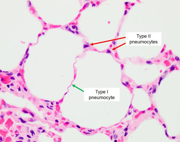 <p>type II pneumocytes </p>
