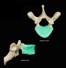 <p>What is the indicated part and vertebrae?</p>