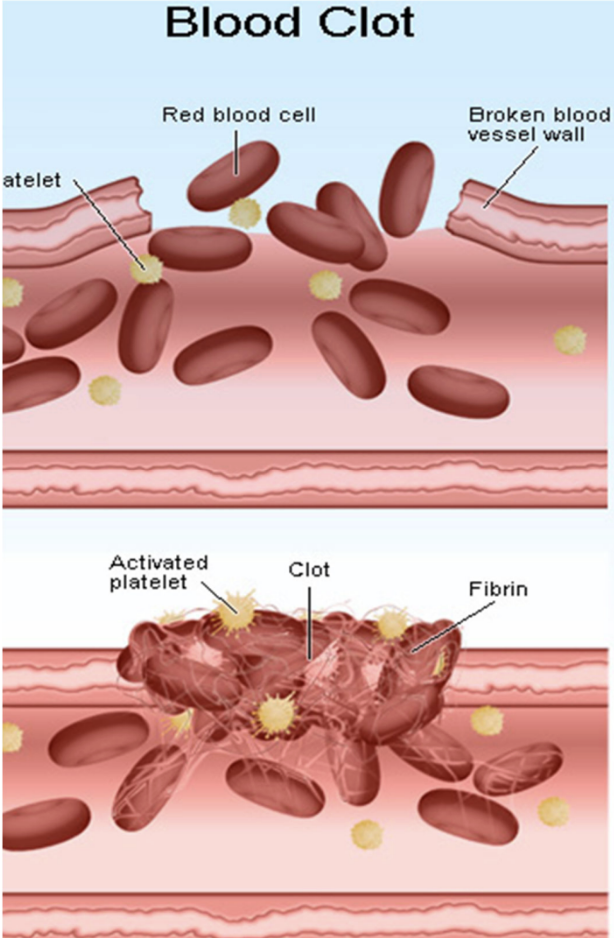 <p>Why did COX-2 inhibitors increase CV risk?</p>
