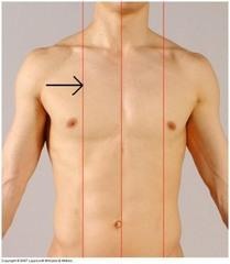 <p>Identify the line</p>