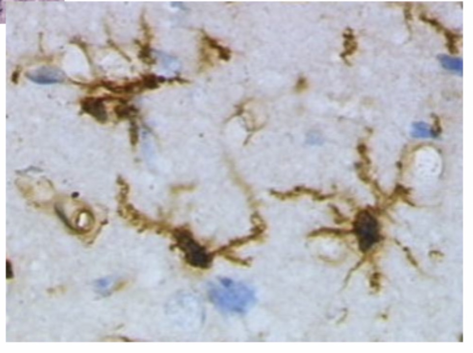 <p>Microglia Cell: Function: <span>Act as CNS immune cells; remove debris and pathogens. Small cells with elongated bodies, elongated nuclei with dense chromatin </span></p>