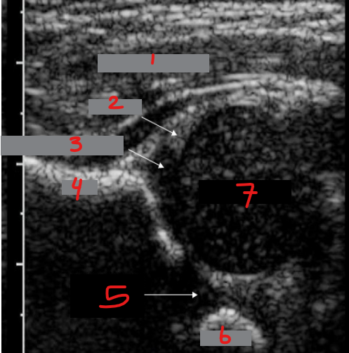 <p>Identify this image. </p>