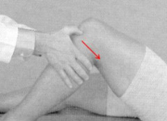 <p>Hip flexed 45°, knee flexed 90°, passive posterior tibial glide; checks PCL integrity.</p>