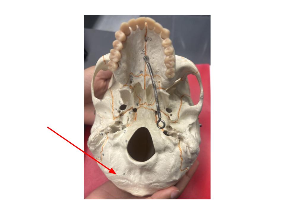<p>base of skull</p>