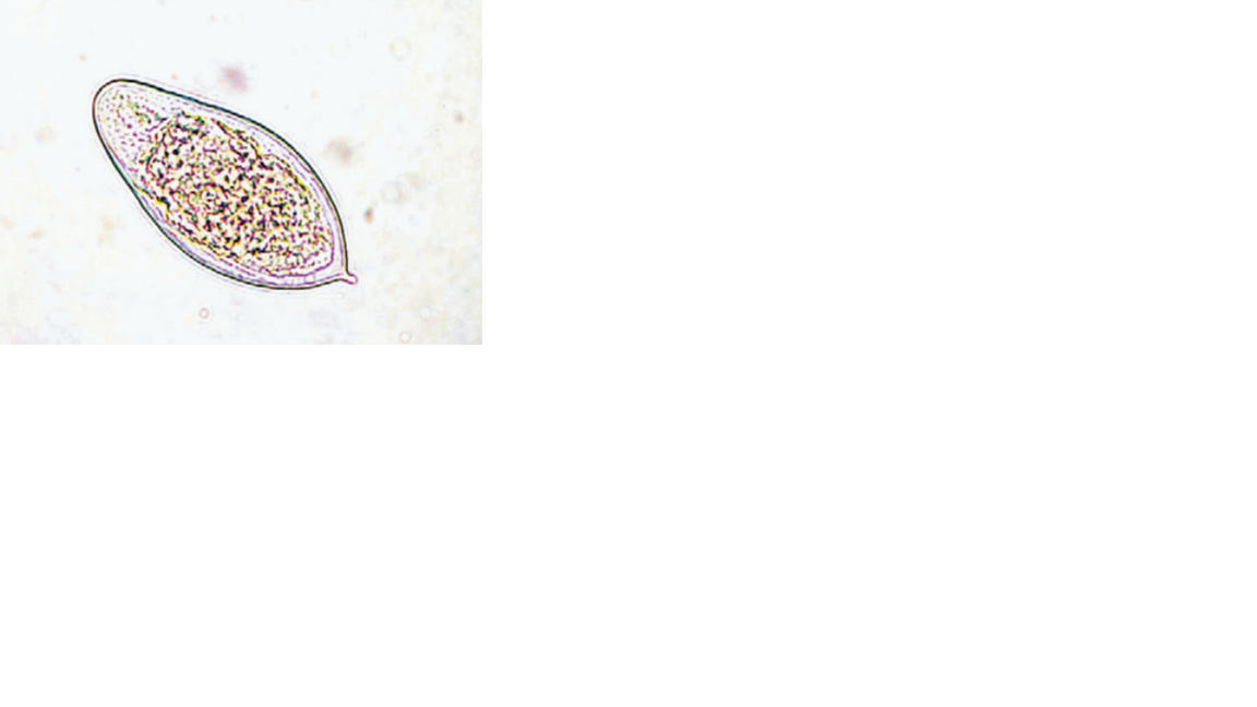 <p>Name the fluke or flatworm</p>