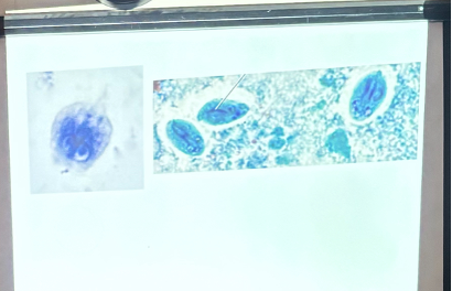 <p>What is this organism?</p>