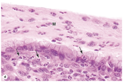 <p>Where in the cervical tissue are leukocytes located?</p>