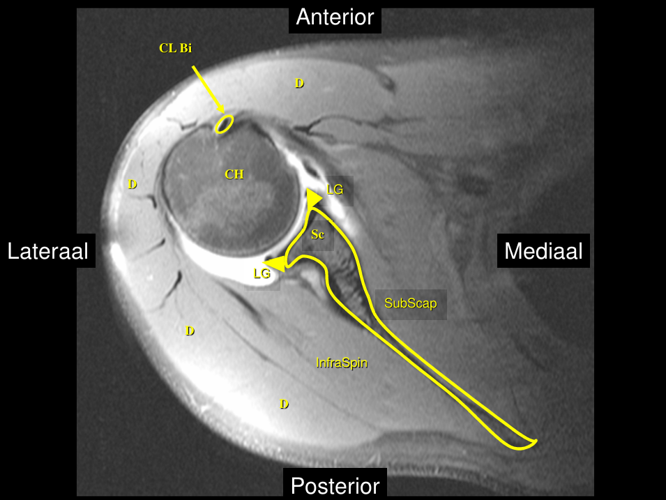 <p><strong>SCHOUDER</strong></p><p>MRI schouder - KENNEN</p>