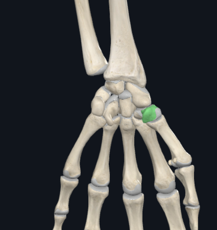 <p>what is this following bone and what section of the hand is it found in?</p>
