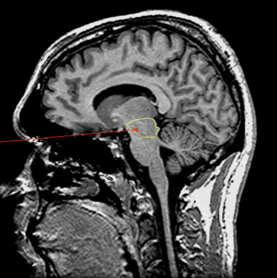 <p>What is the area highlighted called?</p>