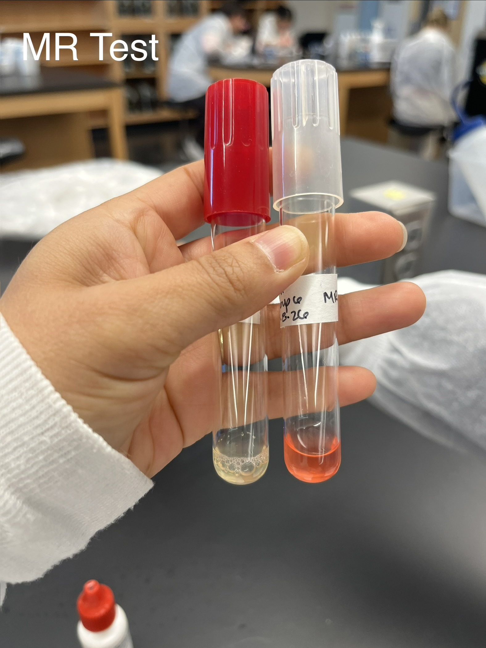 <p><strong>Name: </strong><span style="color: red;">Methyl Red </span>Test</p><p><strong>PURPOSE: </strong>to determine if your organism ferments glucose into mixed acids.</p><p><strong>MEDIA: </strong>glucose supplemented nutrient broth</p><p><strong>INOCULATION GUIDE: </strong>loopful</p><p><strong>INCUBATION: </strong>37°C for 48 hrs.</p><p><strong>THEORY: </strong>glucose is fermented into —> organic acids</p><p><strong>After incubation, add 5 drops of </strong></p><ul><li><p><span style="color: red;">Methyl Red</span>: pH indicator</p></li></ul><p>- Acidic:<span style="color: red;"> red</span></p><p>- Neutral or basic: <mark data-color="#ecda0b" style="background-color: rgb(236, 218, 11); color: inherit;">yellow</mark></p><p><strong>RESULTS: </strong></p><p>(+): <span style="color: red;">red</span></p><p>(-): <mark data-color="#f3f51d" style="background-color: rgb(243, 245, 29); color: inherit;">yellow </mark></p><p></p>