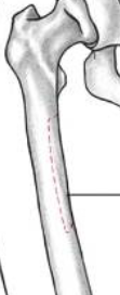 <p><span>Lower 2/3rds of the pectineal</span><br><span>line of the femur and upper</span><br><span>half of the medial lip of the</span><br><span>linea aspera</span></p>