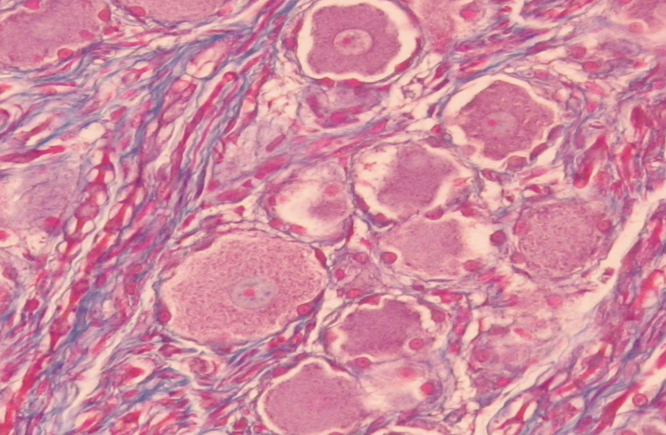 <p><span><strong>Identify the source of nervous tissue shown here.</strong></span></p>