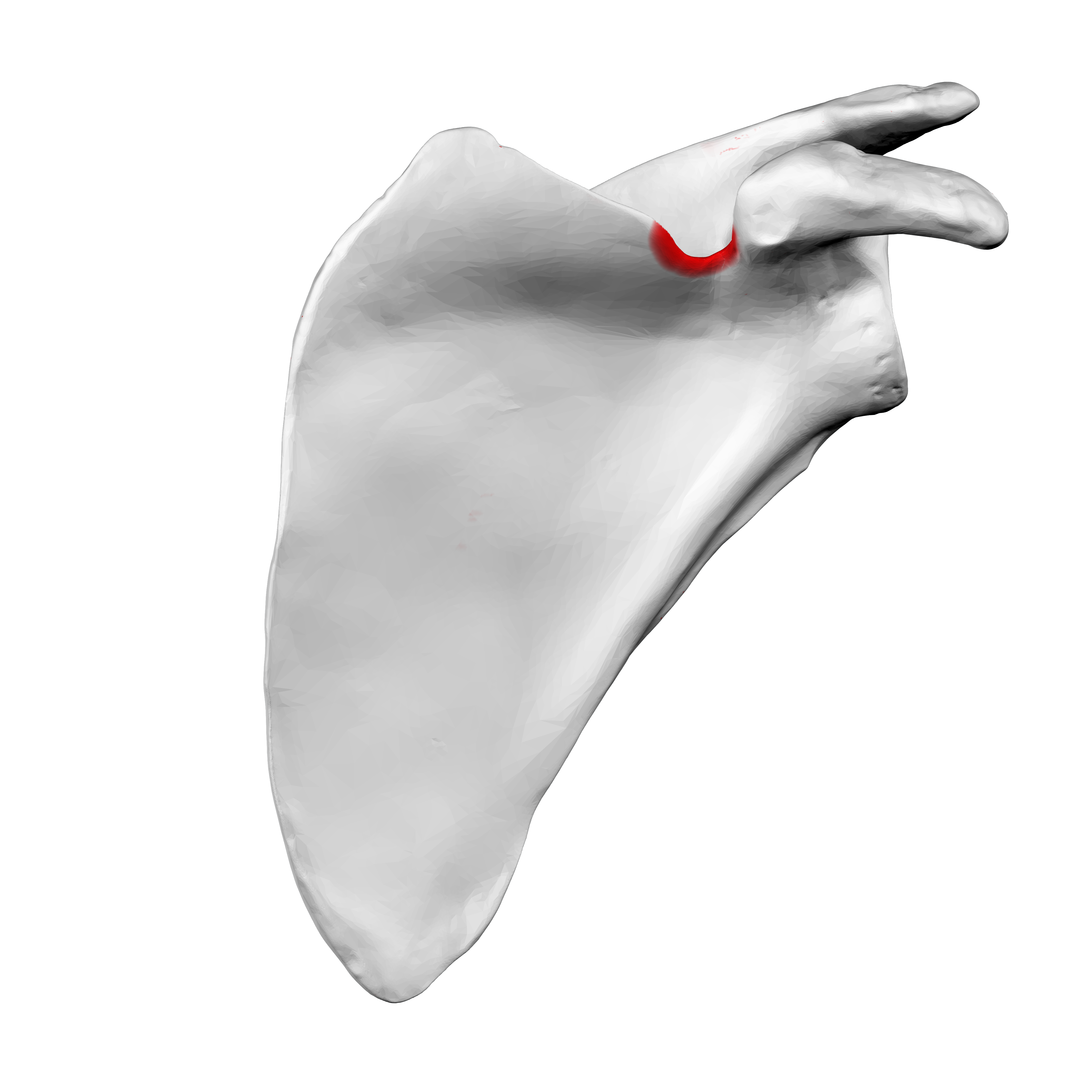 <p>Suprascapular Notch</p>
