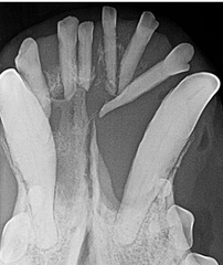 <p>What is this? How do you treat it?</p>