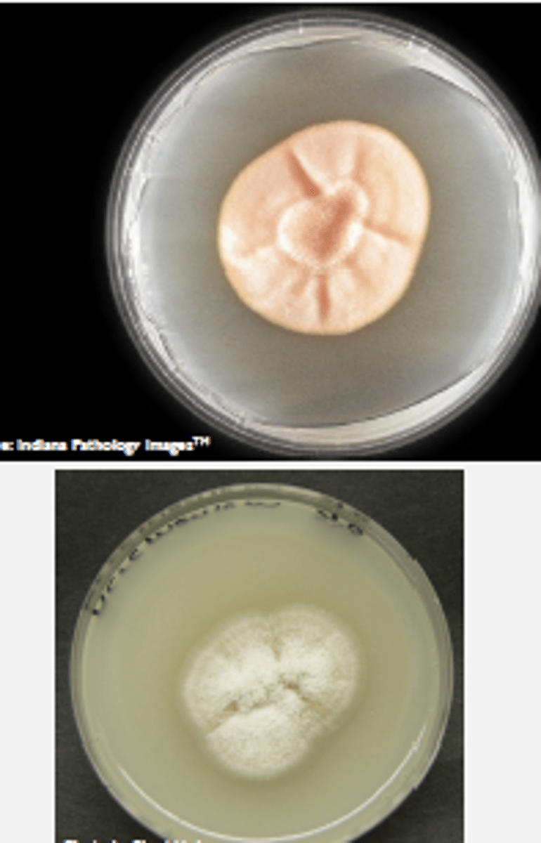 <p>Young = yeast-like</p><p>Older = cottony</p><p>Colorless/pink reverse</p>
