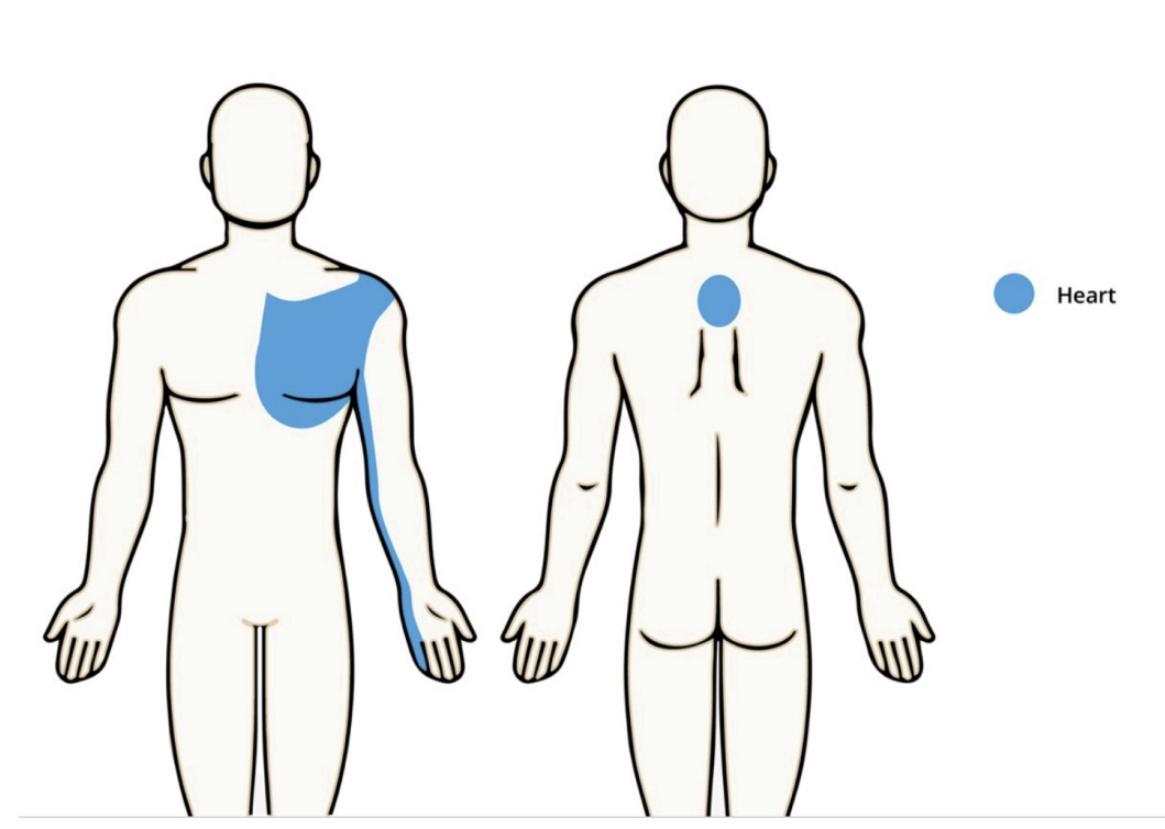 <ul><li><p>chest pain/heaviness/discomfort</p></li><li><p>palpitations or irregular heartbeat</p></li><li><p>fatigue</p></li><li><p>lightheadedness, dizziness, or fainting</p></li><li><p>severe sudden headache</p></li><li><p>difficulty talking or swallowing</p></li><li><p>double vision</p></li><li><p>pulsating or throbbing pain</p></li><li><p>shortness of breath</p></li><li><p>high or low blood pressure</p></li><li><p>limb pain, swelling, or discoloration</p></li><li><p>limb pain during activity</p></li><li><p>wound/ulcers in legs or slow to heal</p></li><li><p>history of CV disease</p></li></ul><p></p>