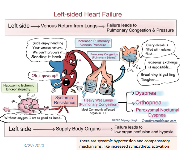 <ul><li><p>dyspnea, orthopnea, paroxysmal nocturnal dyspnea</p></li><li><p>failure for venous return from lungs → <strong>pulm. congestion </strong>(edema) + pulm. venous pressure</p></li><li><p><strong>failure to supply body organs</strong> → low organ perfusion + hypoxia</p></li></ul><p></p>