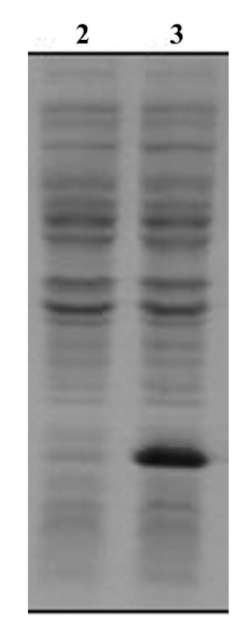 <p>Total proteins from bacterial cells before (lane 2) and after (lane 3) the plasmid was added.</p><p></p><p>Is lane 2 a positive control group or a negative control group?</p>