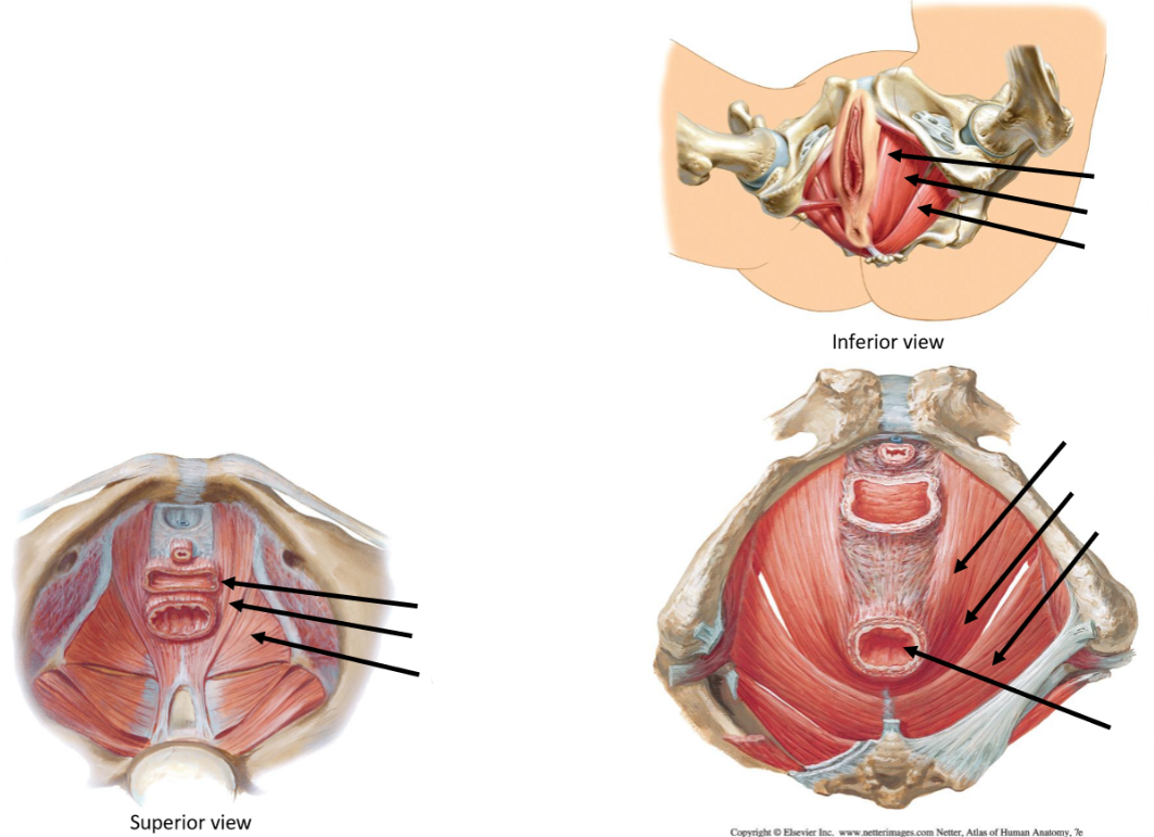 <p>Label the following diagram of the <strong>levator ani </strong>muscles</p>