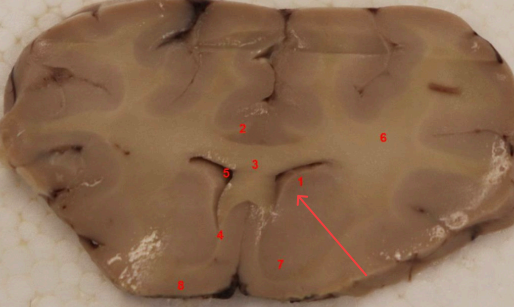 <p>What nuclei is this, function? </p>