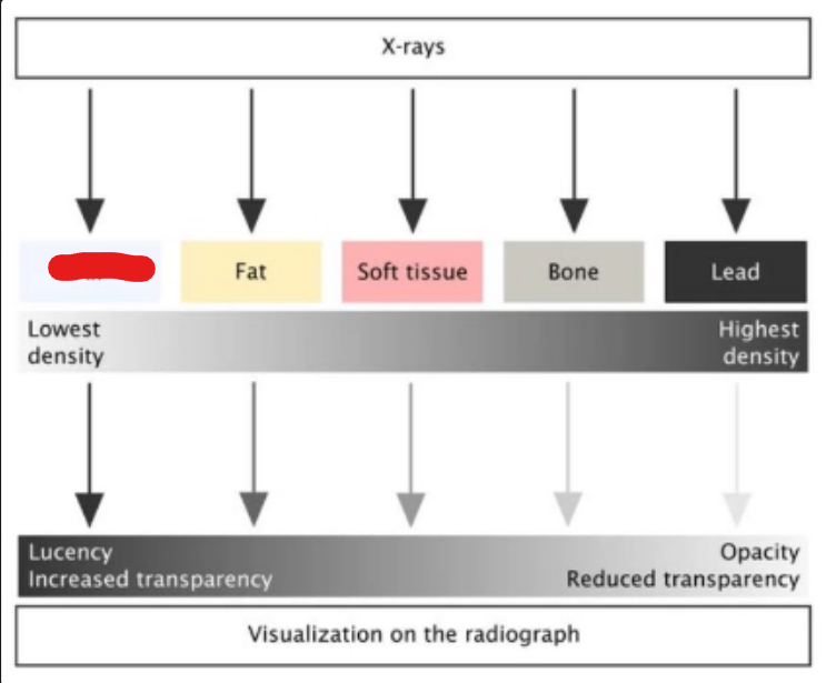 <p>what is it (Intro to Diagnostic Imaging)</p>