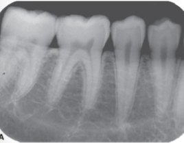 <p>Shows various light and dark shades of gray</p>