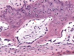 <p>What is indicated by the arrow?</p>