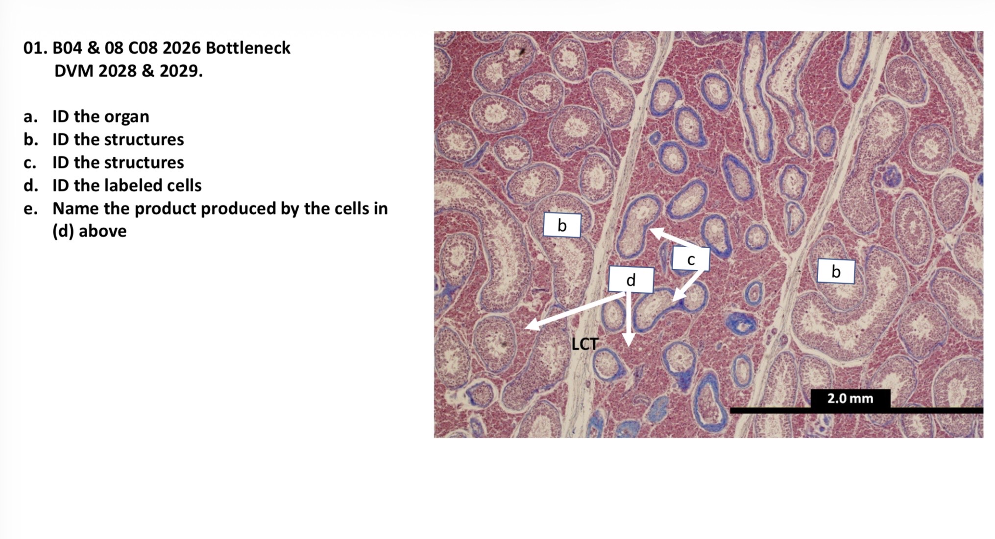 <p>A. Testis</p><p>B. Seminiferous tubules </p><p>C. Rete testis </p><p>D. Leydig cells</p><p>E. Testosterone </p>