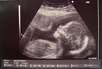 <p>Pre-</p>