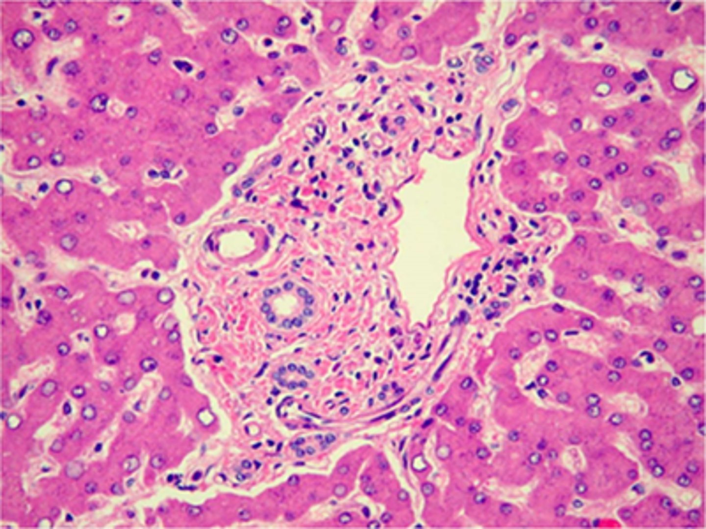 <p>portal triad</p><p>Feedback:</p><p>This is a portal triad in a section of liver. It is so named because it contains branches of three different structures: hepatic portal vein, h You answered the question correctly.</p>