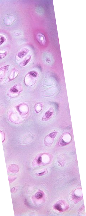 <p>Hyaline Cartilage</p>