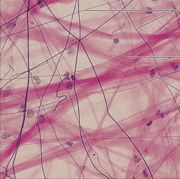 <p>what is the name of this tissue?</p>