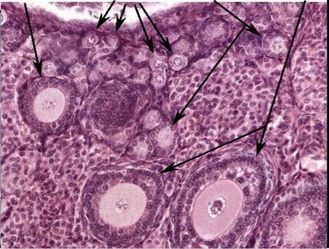 <p>What is structure C?</p>
