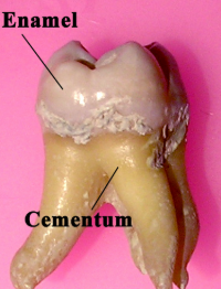 <p>Tissue covering root of tooth</p>