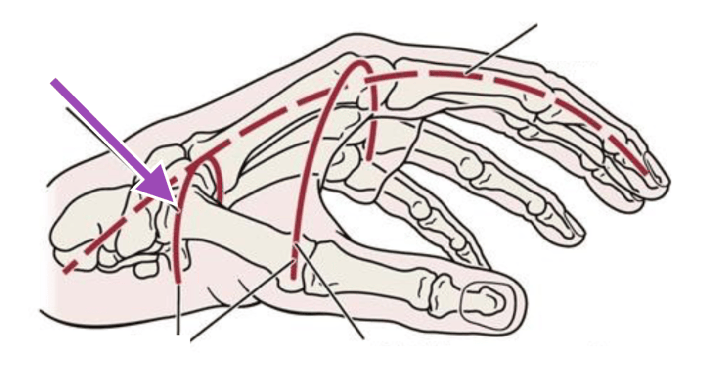 <p>(aka. Carpal Arch)</p><p>Formed by the distal row of carpal bones</p><p>-arch right above wrist on the palm side</p><p>-forms the "Carpal Tunnel"</p><p>Contains:</p><p>-Median n. </p><p>-9 Extrinsic Flexor Tendons</p>
