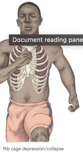 <p>Rib Cage Exhalation (rib cage depression) </p>