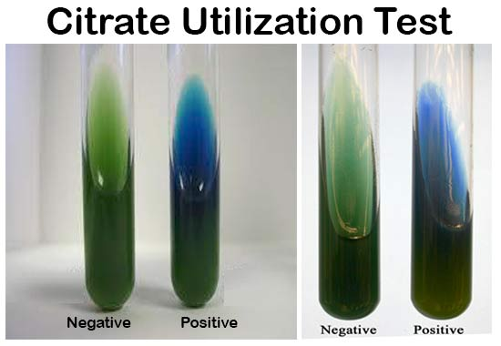 <ul><li><p>Detects if bacteria can use citrate as a carbon and energy source </p></li><li><p>Positive: blue medium </p></li><li><p>Negative: medium remains green </p></li></ul><p></p>