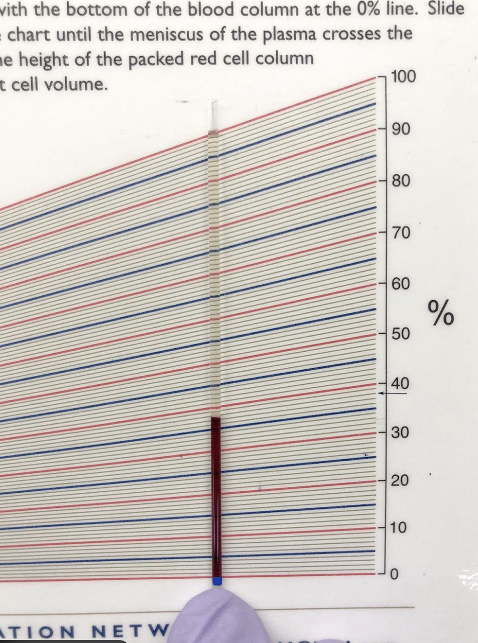 <p>Measure RBC layer ÷ total blood column × 100</p>
