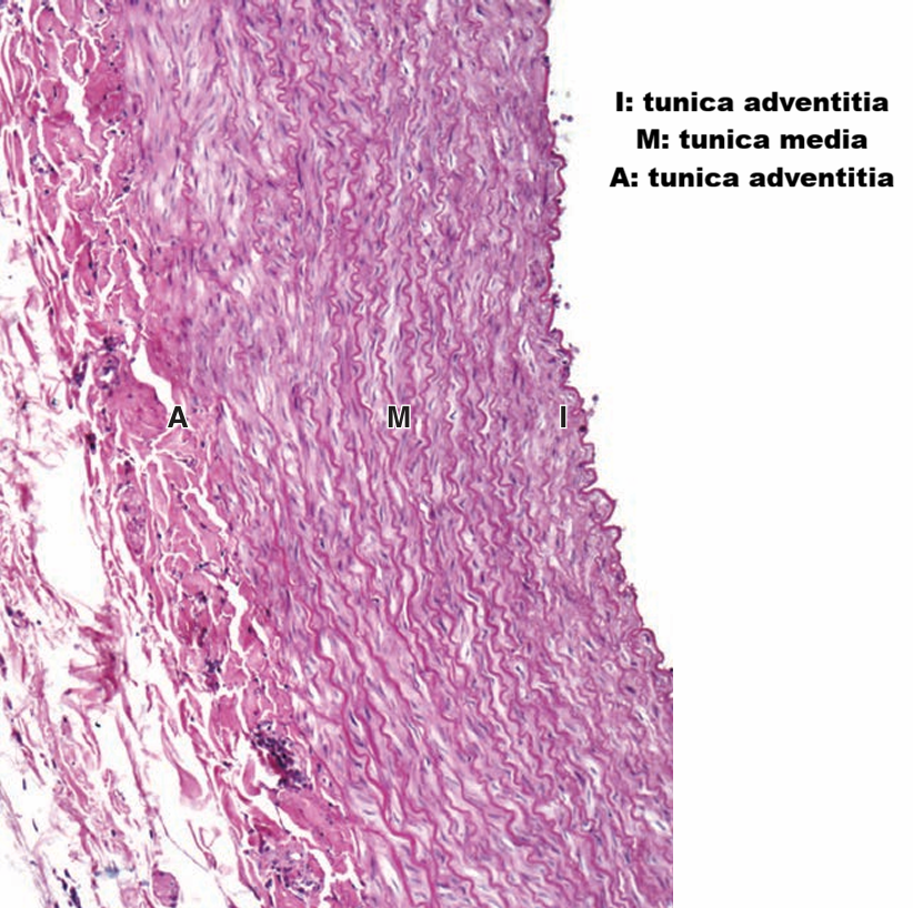 <p>Type bloedvat</p>