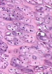 <p>What type of cartilage?</p>