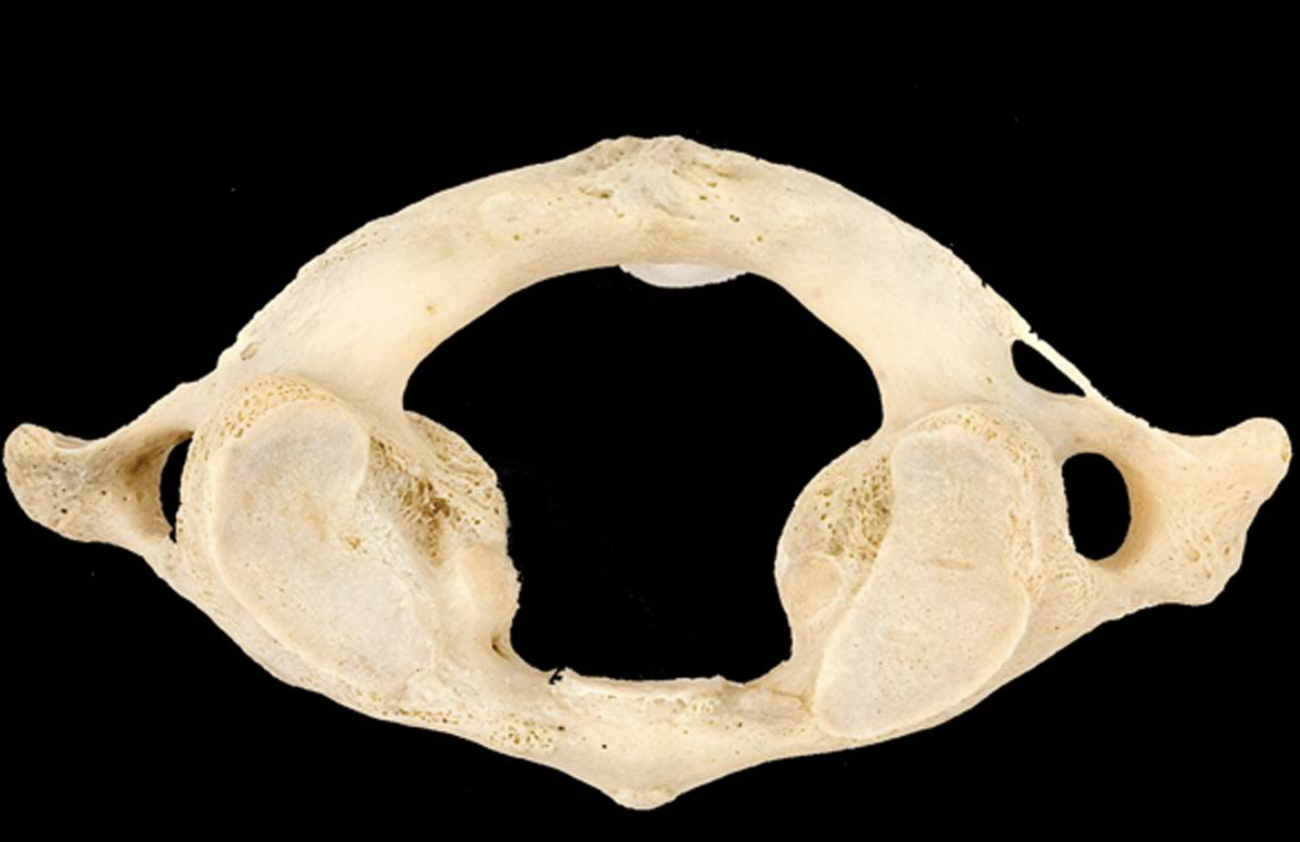 <p>What bone is this?</p>