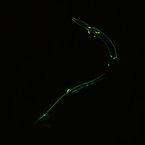 <p>Uses UV (short wavelength) light </p><p>Fluorescent substance absorb UV light and emit longer wavelength (visible) light </p><p>Cells stained with dyes </p><p>Appears as bright objects against dark background</p>