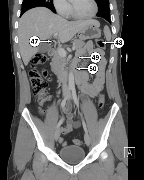 <p>48 and 49 are flexures. Please label the different flexures </p>