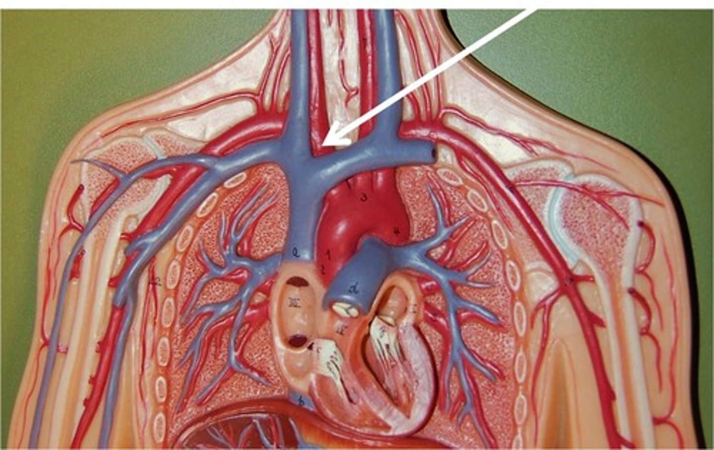 <p>brachiocephalic</p>