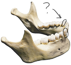 <p>Name these teeth.</p>